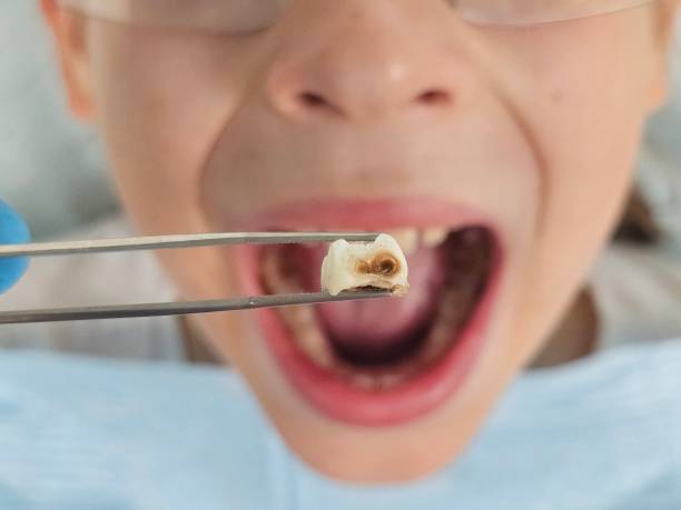 Best Emergency Dental Surgery in Rutledge, GA